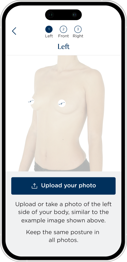Natrelle® 3D Breast Visualizer
