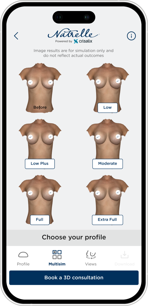 Natrelle® 3D Breast Visualizer