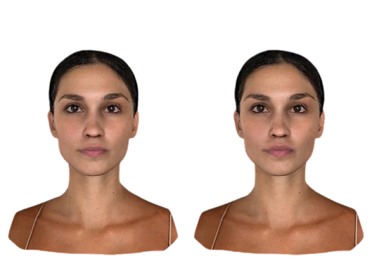 【裁断済み】Aesthetic Plastic Surgery Aesthetic Plastic Surgery | springermedicine.com